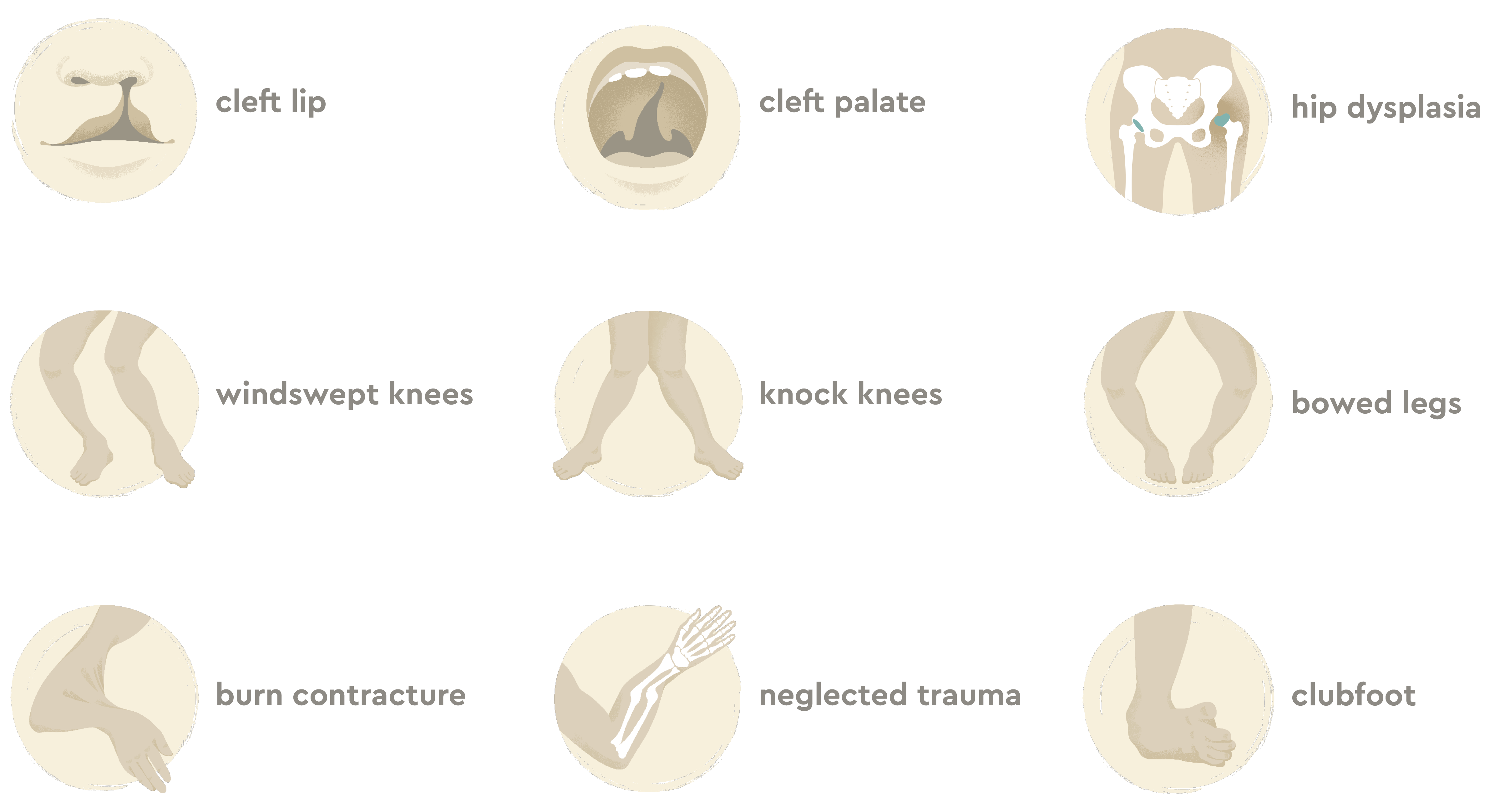 Conditions treated by CURE Organization